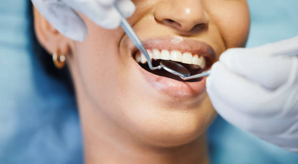 Best Emergency Treatment for Oral Infections in Obetz, OH